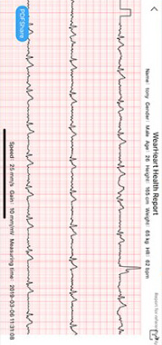 Zeblaze Vibe 3 ECG Heart Rate