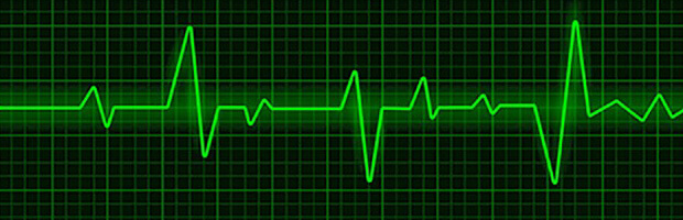 Zeblaze Vibe 3 ECG monitor