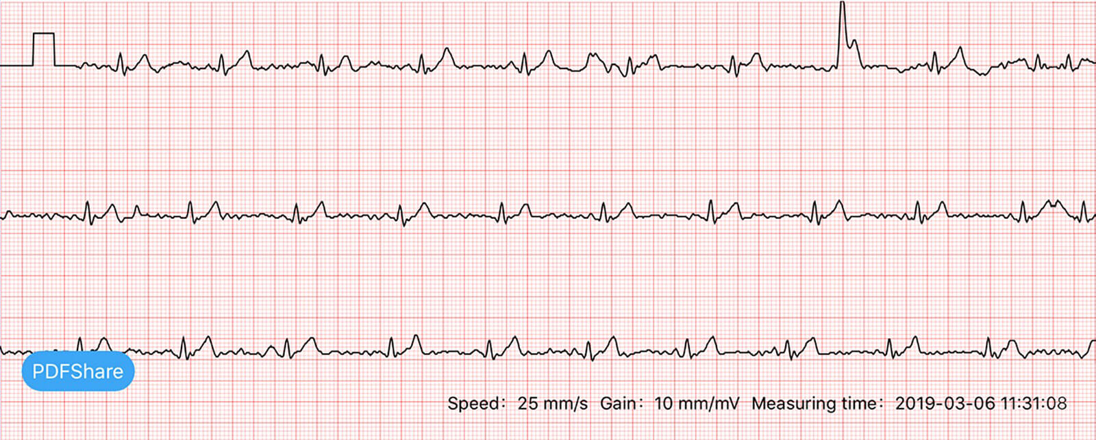 Vibe 3 outlet ecg